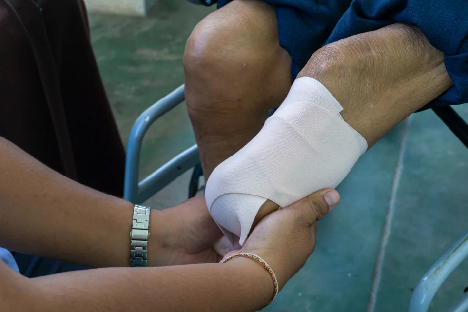 New Jersey Amputation Injury Lawyers practice area